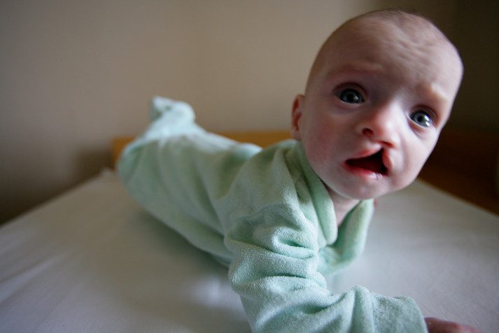 Киев, 12 августа 2005 г. Брошенные ВИЧ-позитивные дети в инфекционном отделении детской больницы № 1 г. Киева.