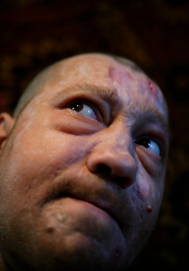 Полтава, 12 августа 2005 г.
В маленькой квартире бедного района Полтавы 39-летний Дима, наркозависимый с более чем 20 летним стажем, сидит, задумавшись, перед введением очередной дозы. Дима и его брат, 36-летний Руслан. У них обоих уже есть дети. Их мама Алла потеряла мужа 15 лет назад и вынуждена была уволиться из садика, где она работала воспитательницей, чтобы присматривать за ее сыновьями, которые употребляют наркотики.