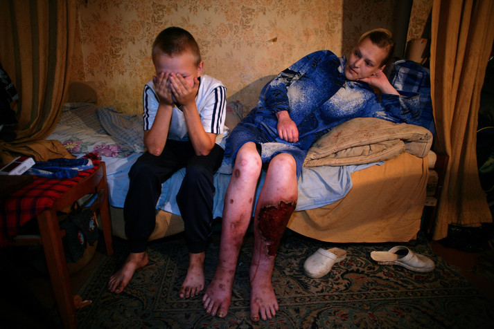 Полтава, 12 августа 2005 г.
Таня, 29 лет, наркозависимая работница коммерческого секса, ВИЧ-позитивная. На снимке она со своим одиннадцатилетним сыном Виталием. Он не ходит в школу, проводит весь день, играя в компьютерные игры и мечтая об Африке, где бы он с удовольствием ничего не делал. Когда его спросили, знает ли он, что его мама употребляет наркотики, он отвечает: «Да, но я не хочу об этом говорить». Они живут с пятью другими работницами коммерческого секса в маленькой квартире в бедном районе.