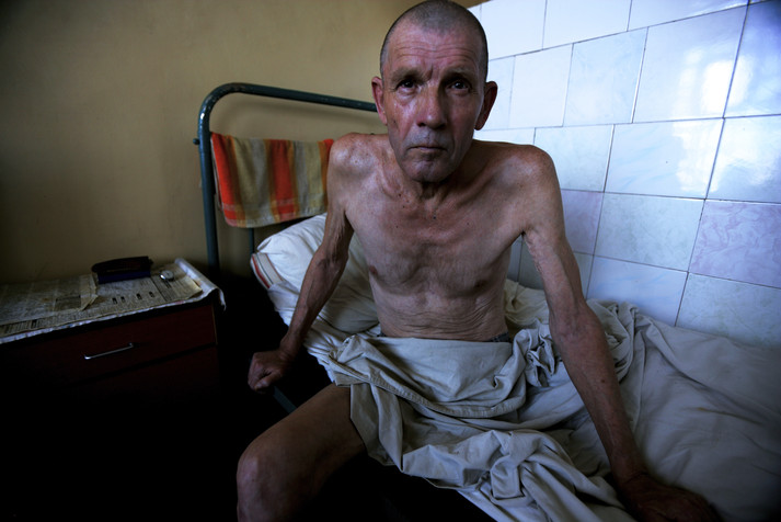 Херсон, 18 августа 2005 г.
Заключенный с тяжелыми последствиями ВИЧ-инфекции в палате интенсивной терапии в больнице для заключенных с ВИЧ/СПИДом херсонской тюрьмы.