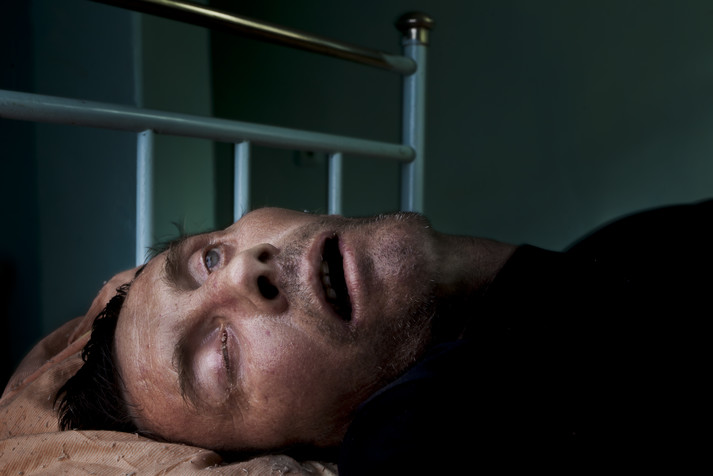 Психоневрологический диспансер. Кривой Рог, Днепропетровская область, август 2011.
Пациент психоневрологического диспансера в Кривом Роге находится в коме. У него последняя стадия СПИДа. Он умирает от болезней, вызванных крайне низким уровнем иммунитета. Одна из причин того, что он оказался в таком состоянии, – отсутствие доступа к препаратам антиретровирусной терапии. Из-за не проведенных вовремя тендеров по закупке антиретровирусной терапии многие пациенты умирают, не получая доступа к лекарствам, жизненно важным для поддержания их здоровья.