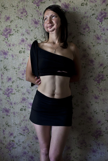 Харьков, август 2011.
Оксана, 33 года. ВИЧ-позитивная. Принимает наркотики, хочет бросить и начать новую жизнь, есть муж, с которым она расписалась в следственном изоляторе. Он отбывает наказание за кражу и употребление наркотиков. Она лишилась нижней челюсти из-за инфекции, вызванной грязными компонентами ее самодельных наркотиков. Ее первый муж избивал ее (сейчас он в тюрьме), шрам на ее животе – результат одного из таких избиений (удара ножом). Несмотря на все это Оксана остается оптимисткой. У нее есть 12-летняя дочь.